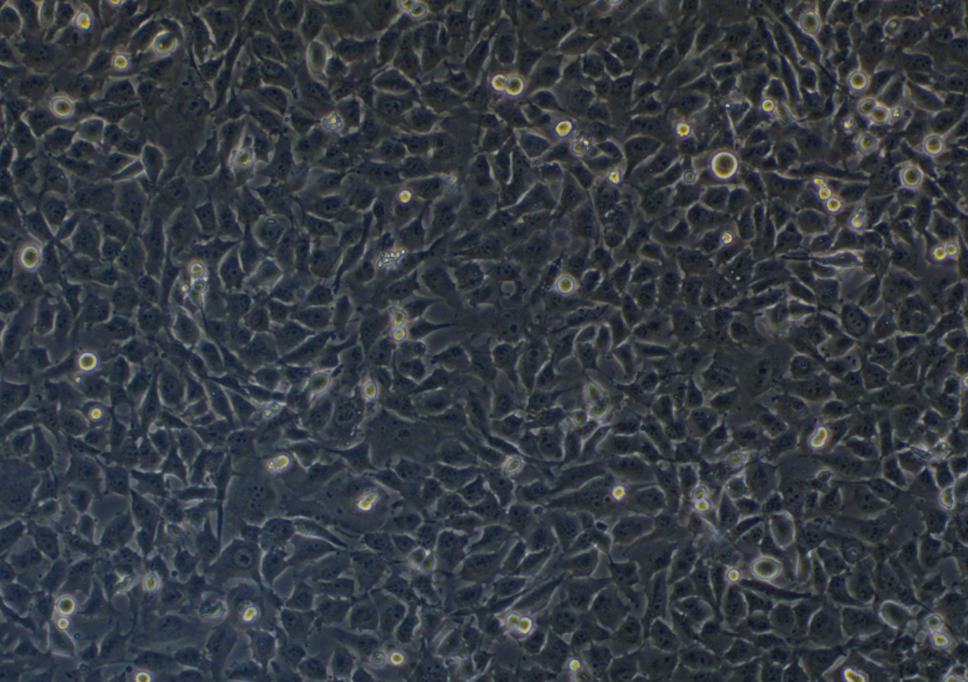 人侵襲性脈絡膜黑色素瘤細胞MUM2B(STR鑒定正確)