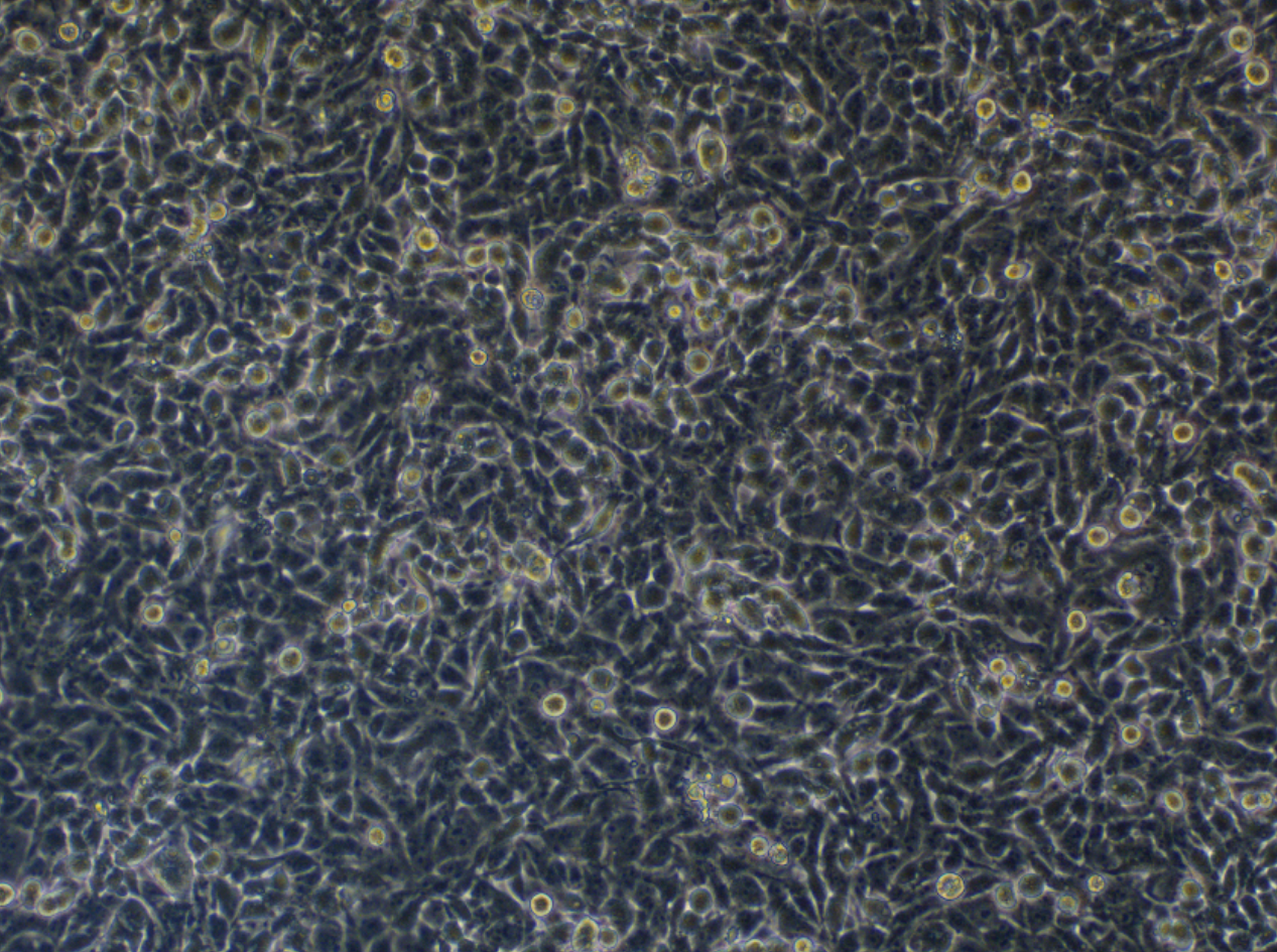 人眼脈絡黑色瘤細胞胞c918(STR鑒定正確)