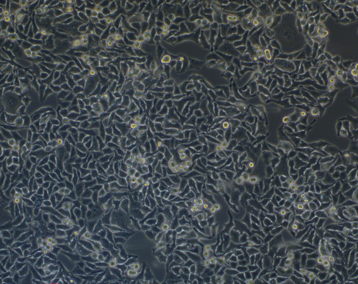 人宮頸癌細胞Hela (STR鑒定正確)