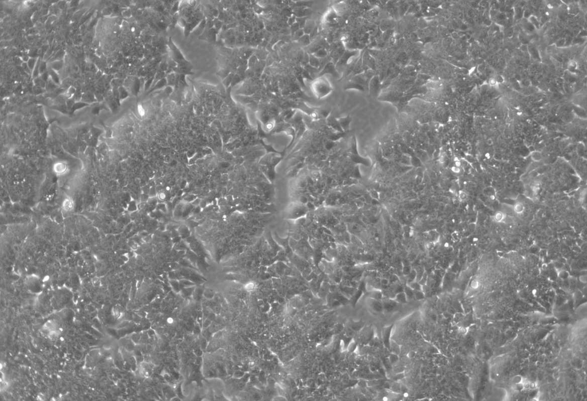 人結腸癌細胞HCT-8(STR鑒定正確)