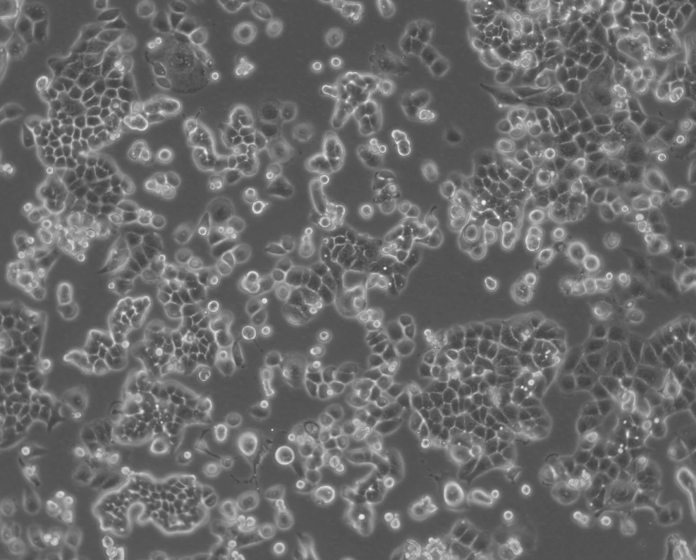 人子宮內膜癌細胞HEC-1-B(STR鑒定正確)