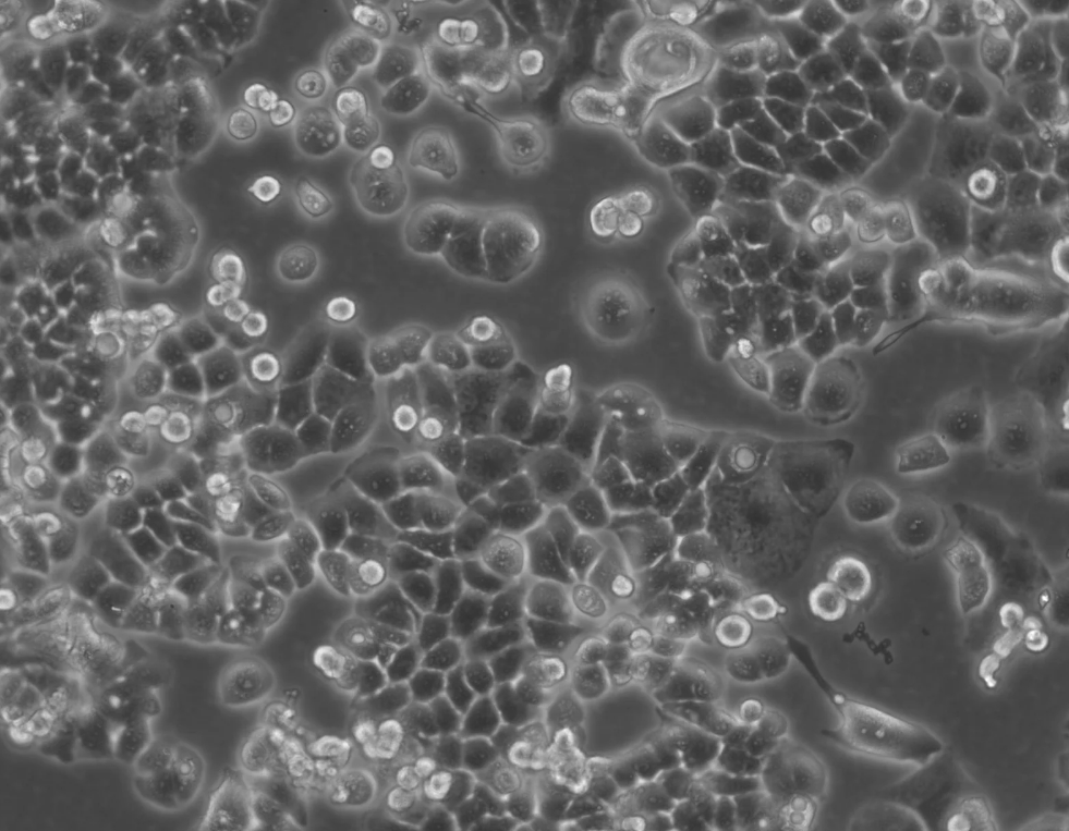 人子宮內膜癌細胞HEC-1-B(STR鑒定正確)