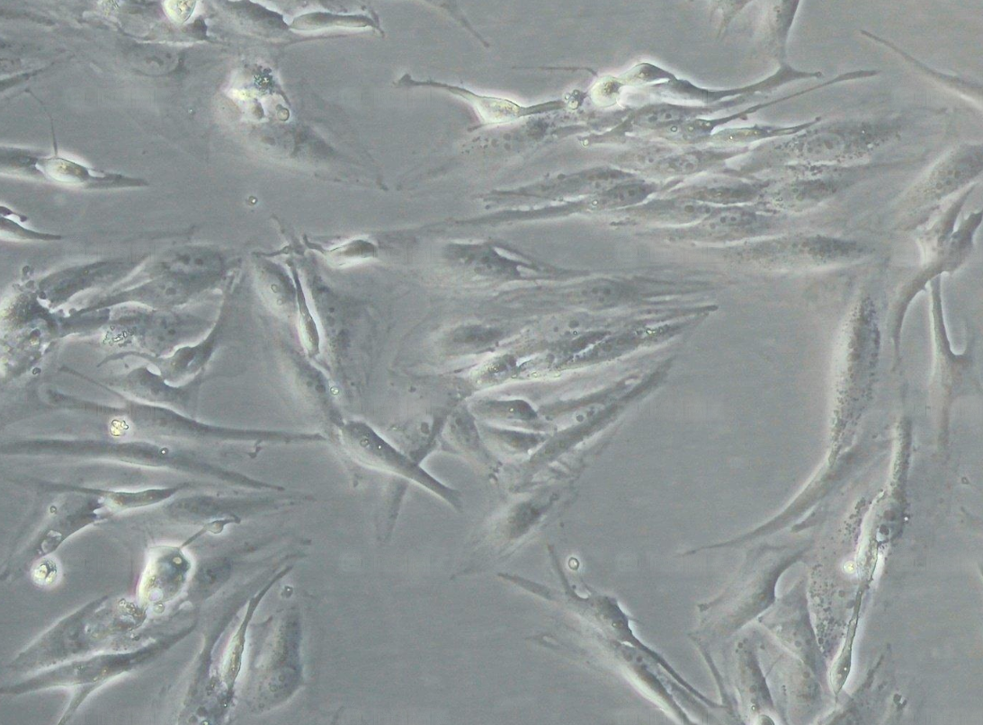 人腎透明細胞癌Caki-1(STR鑒定正確)