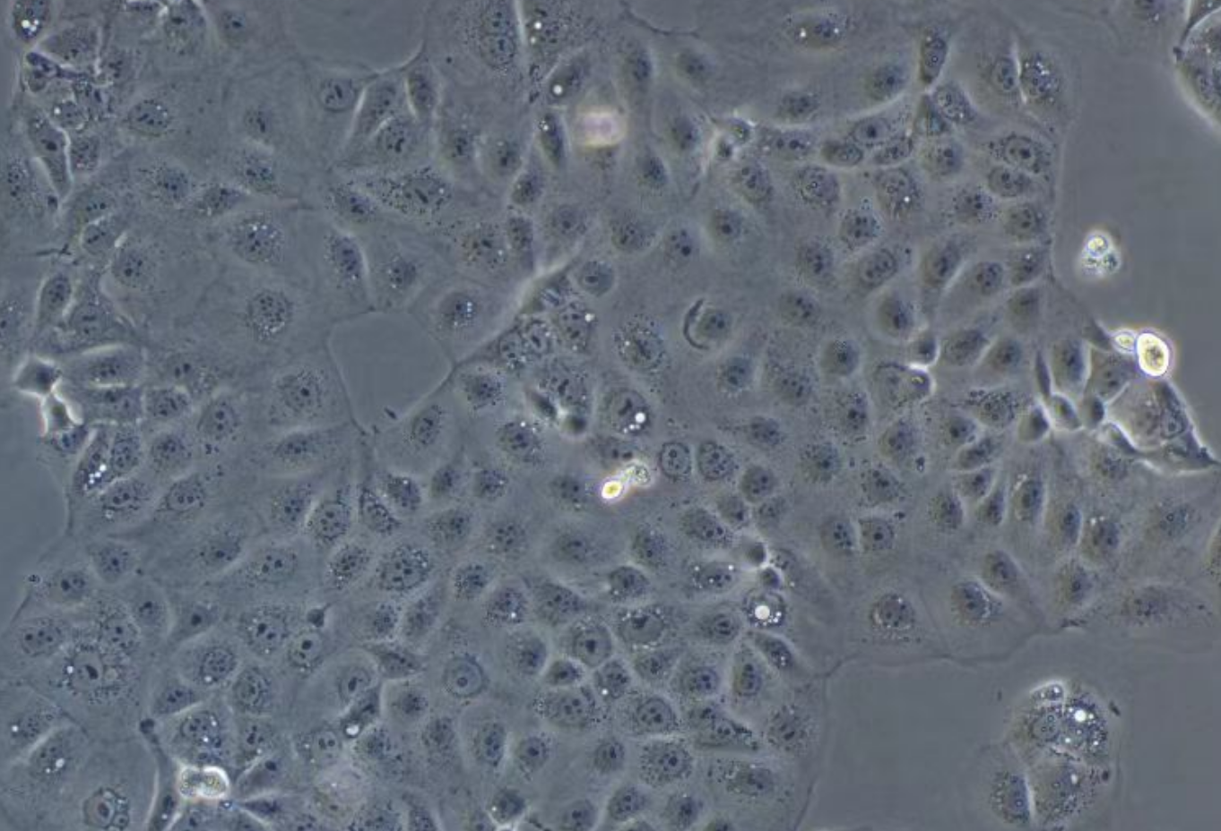 人肝母細胞瘤細胞HuH-6(STR鑒定正確)