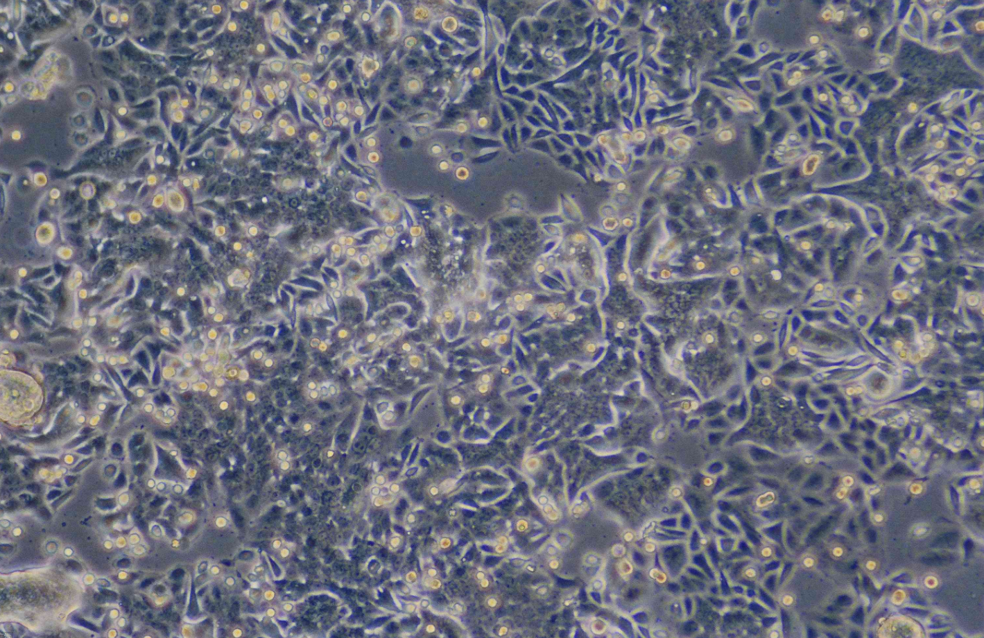 人結腸癌細胞SW480(STR鑒定正確)