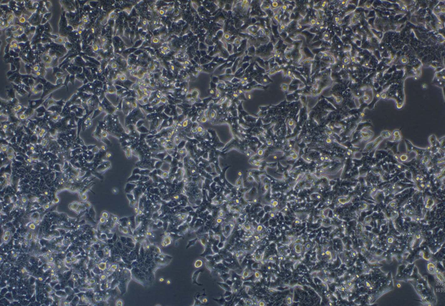 人結腸癌細胞LOVO(STR鑒定正確)