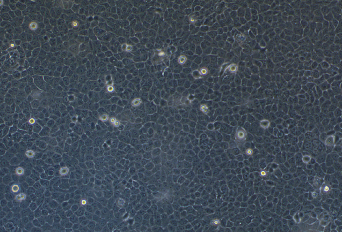 人前列腺增生細(xì)胞BPH-1 ?(STR鑒定正確)