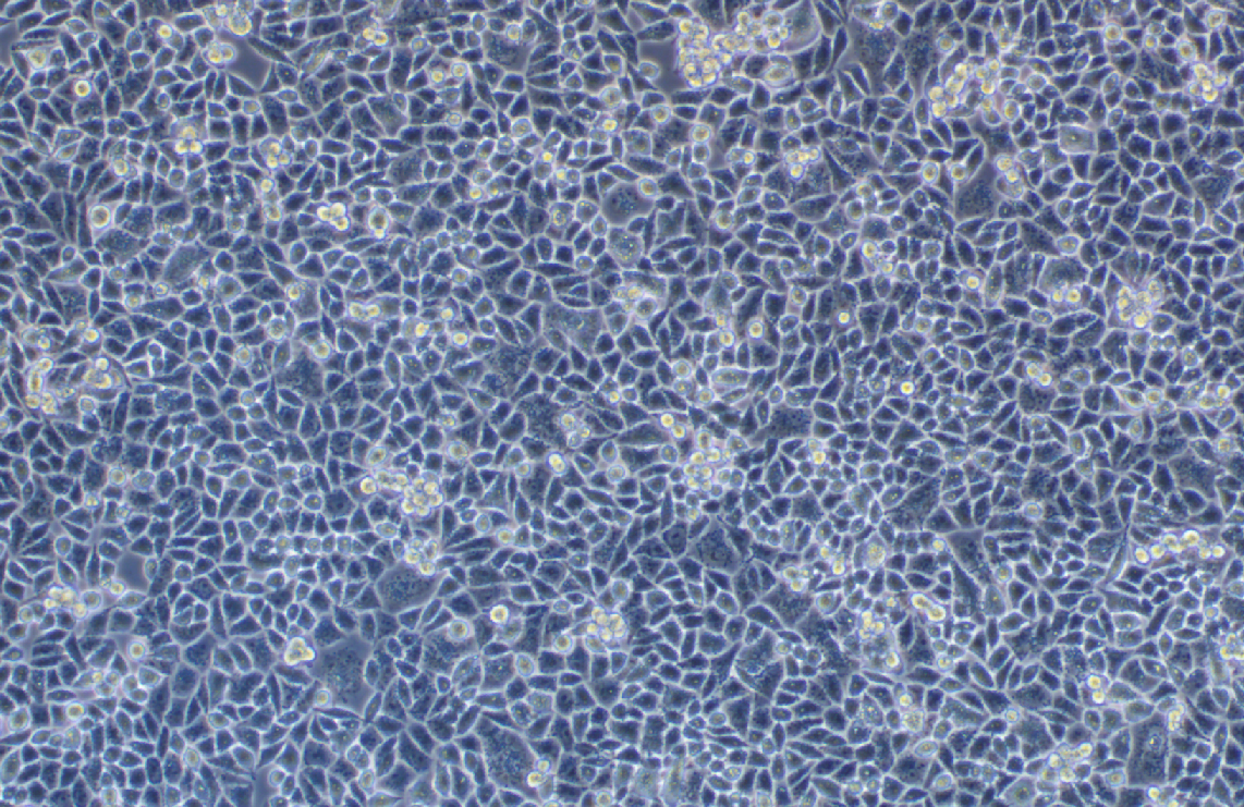 人子宮內(nèi)膜腺癌(轉(zhuǎn)移)細胞AN3CA(STR鑒定正確)