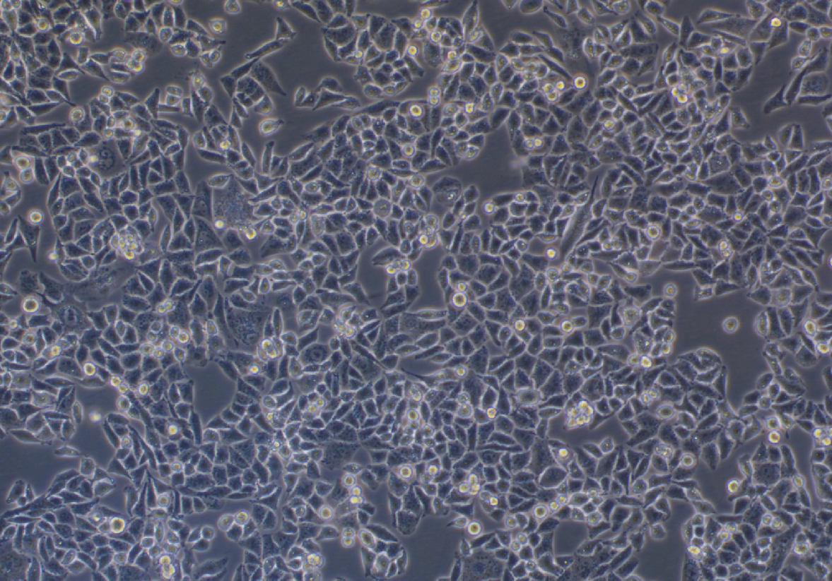 人子宮內(nèi)膜腺癌(轉(zhuǎn)移)細胞AN3CA(STR鑒定正確)