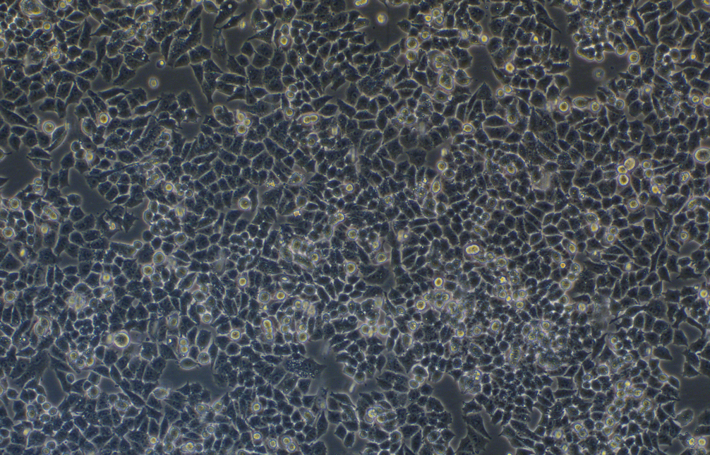人卵巢癌細胞A2780(STR鑒定正確)