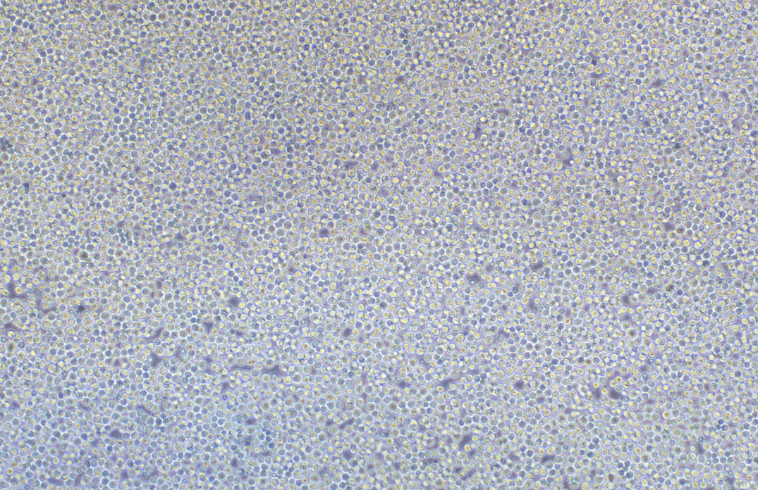 人B淋巴細胞瘤細胞RAMOS(STR鑒定正確)