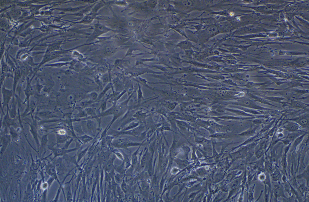 人腦血管周細胞