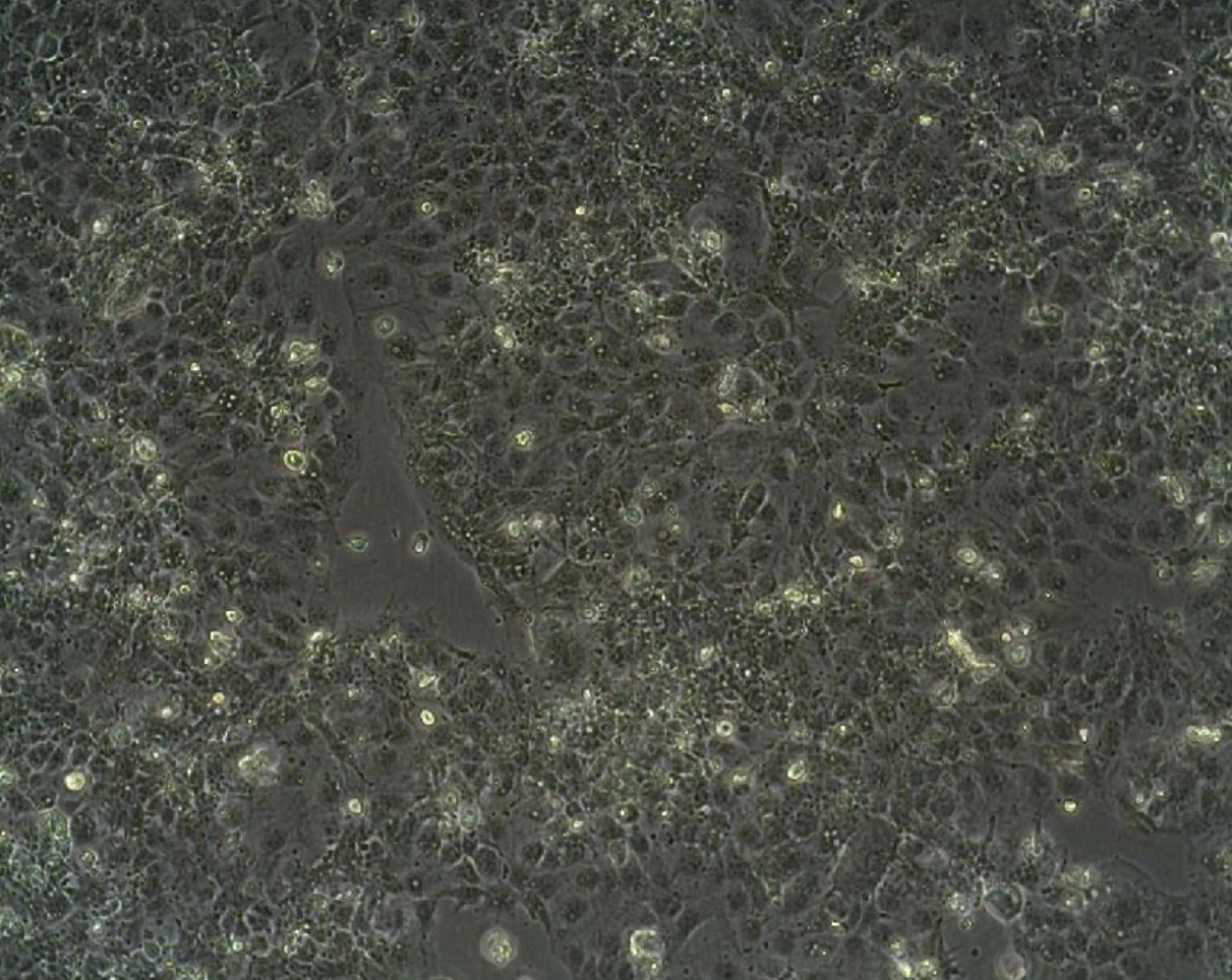 人胎盤絨毛癌細胞JAR(STR鑒定正確)