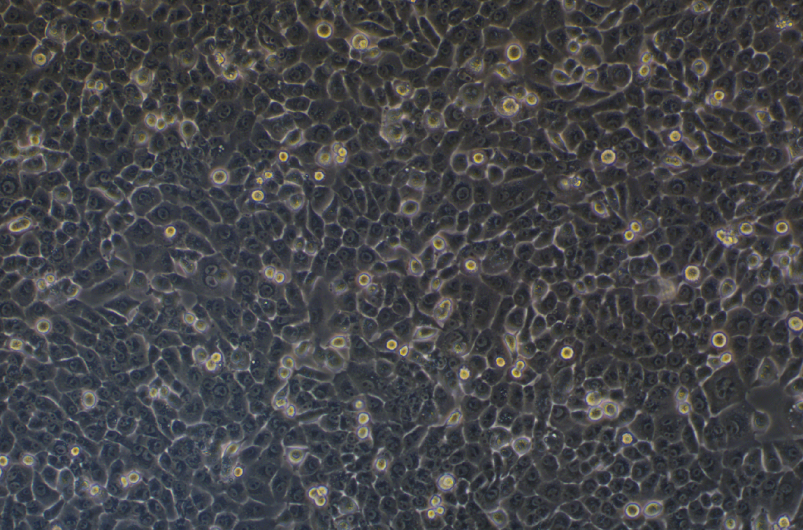 人舌鱗癌順鉑耐藥株CAL 27+DDP(STR鑒定正確)