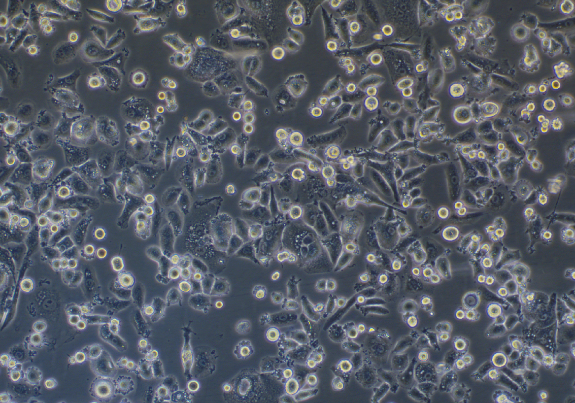 人脊索瘤細胞U-CH1(STR鑒定正確)