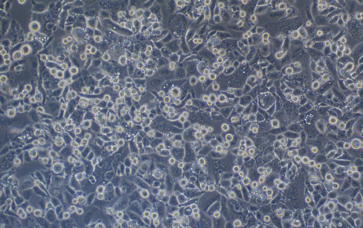 人脊索瘤細胞U-CH1(STR鑒定正確)