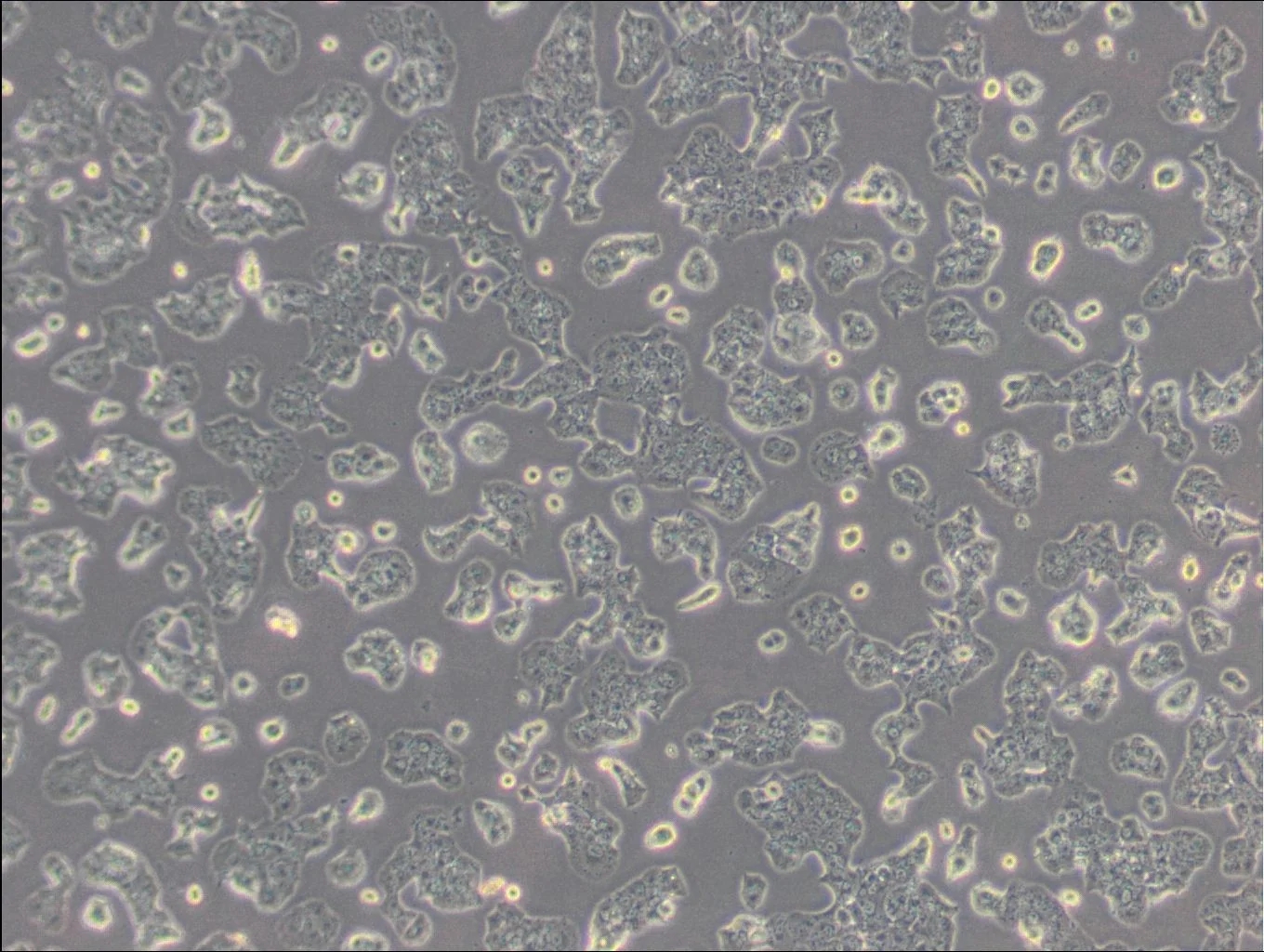 小鼠胰島素瘤胰島β細胞Beta-TC-6(種屬鑒定)