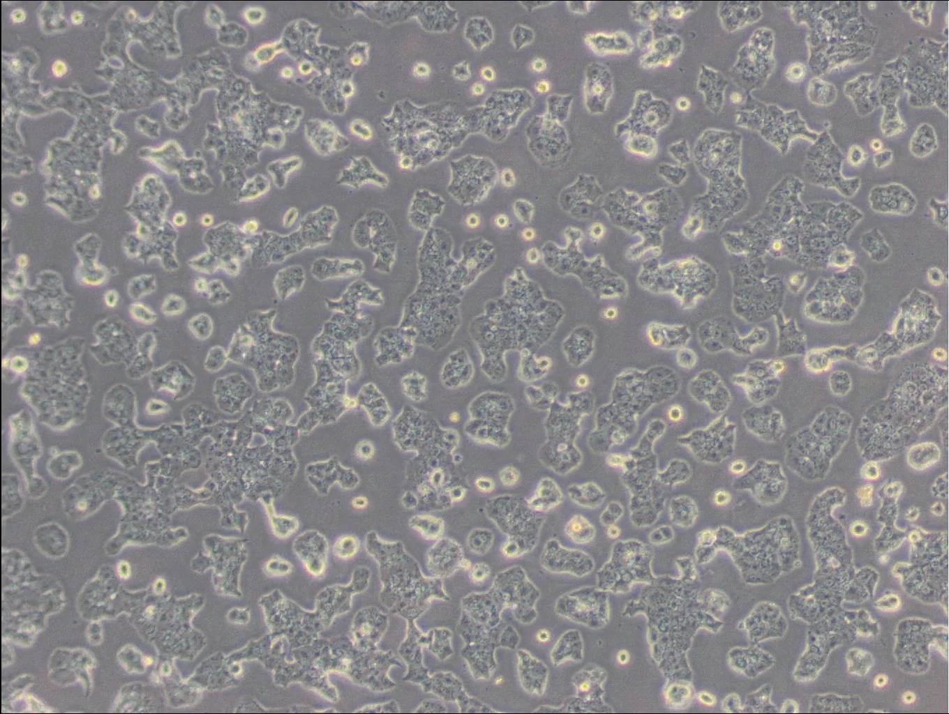 小鼠胰島素瘤胰島β細胞Beta-TC-6(種屬鑒定)