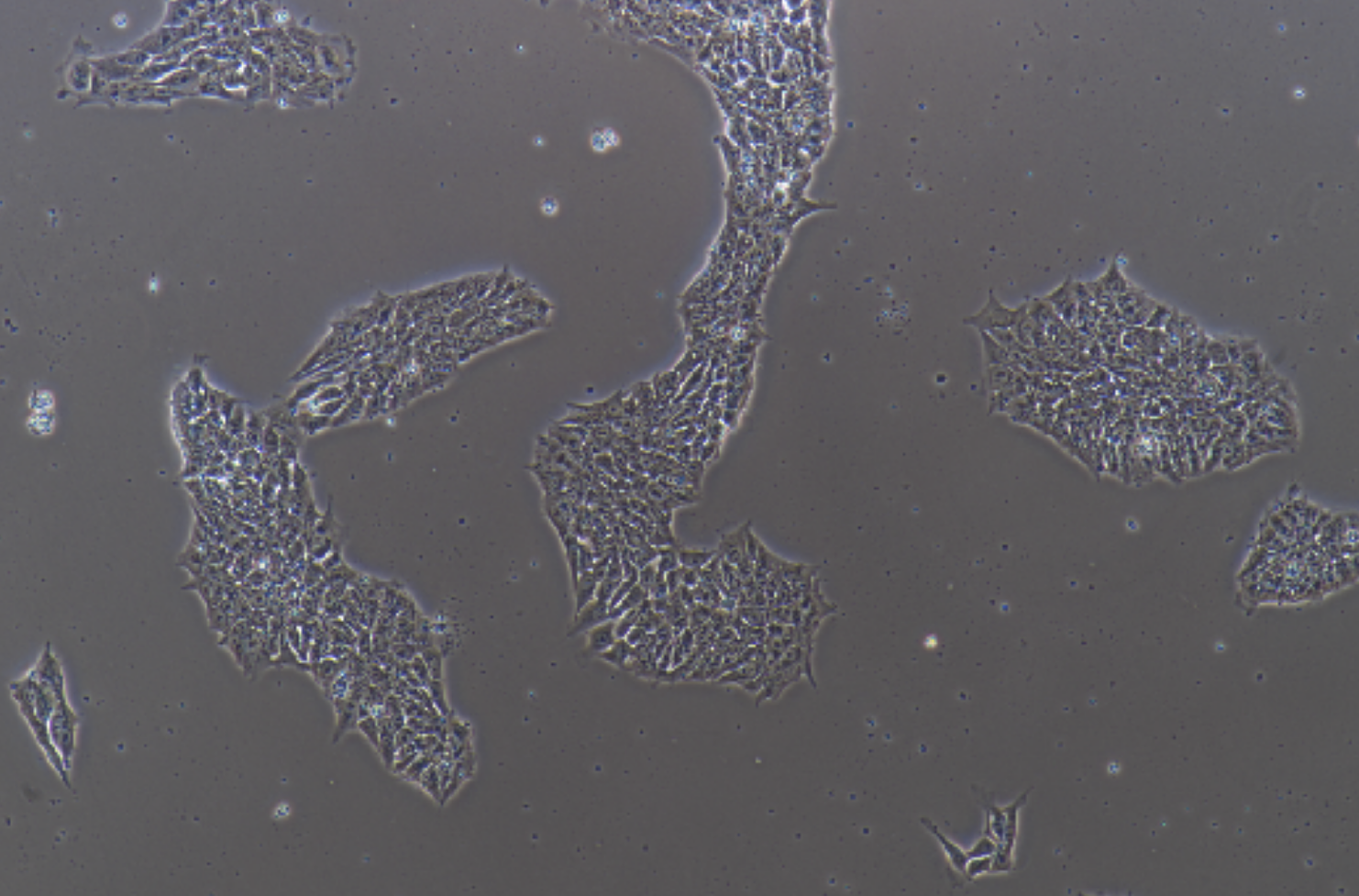 多功能誘導干細胞iPS(STR鑒定正確)