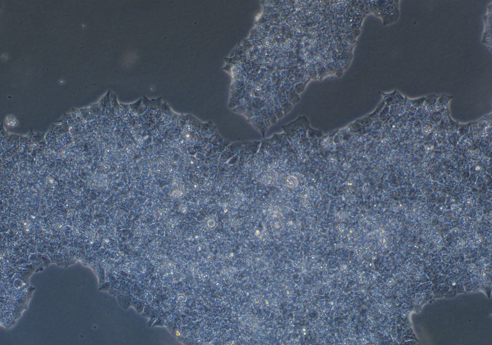 人乳腺導(dǎo)管癌細(xì)胞BT474(STR鑒定正確)