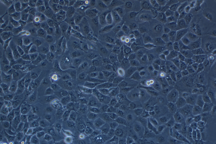 人類鱗狀上皮舌癌細胞SCC-9 (STR鑒定正確)