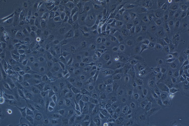 人類鱗狀上皮舌癌細胞SCC-9 (STR鑒定正確)