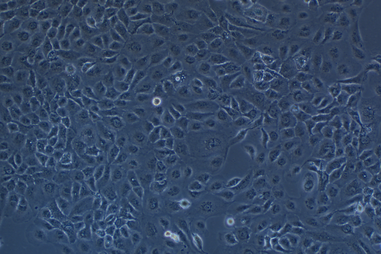 人類鱗狀上皮舌癌細胞SCC-9 (STR鑒定正確)