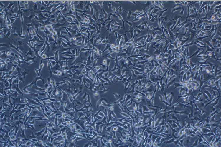 小鼠黑色素瘤細(xì)胞轉(zhuǎn)染B16-F10+OVA(種屬鑒定)