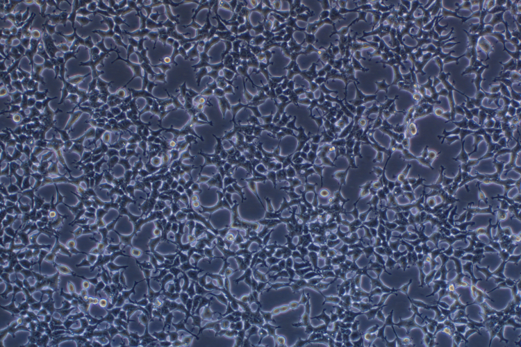 人胚腎細胞293T(STR鑒定正確)
