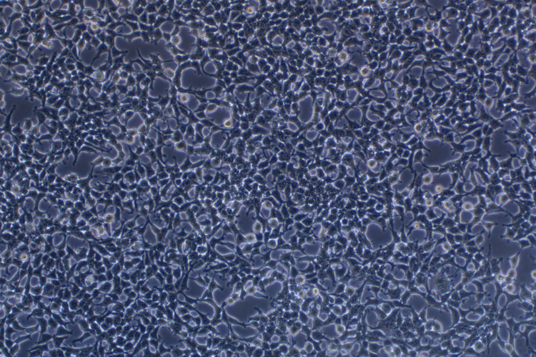 人胚腎細胞293T(STR鑒定正確)