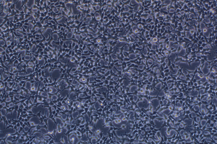 人胚腎細胞293T(STR鑒定正確)