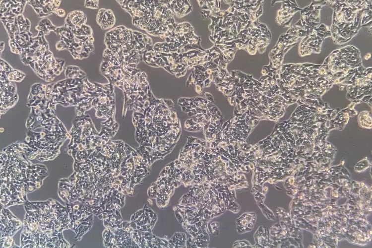 人肝癌細(xì)胞HepG2 (STR鑒定正確)