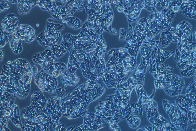 人肝癌細(xì)胞HepG2 (STR鑒定正確)