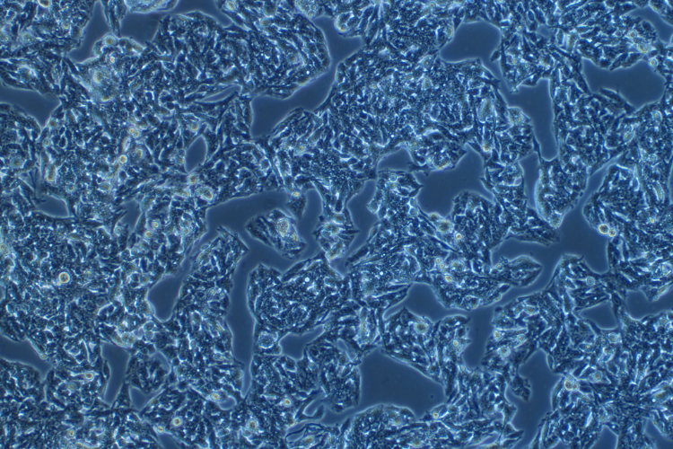 人肝癌細(xì)胞HepG2 (STR鑒定正確)