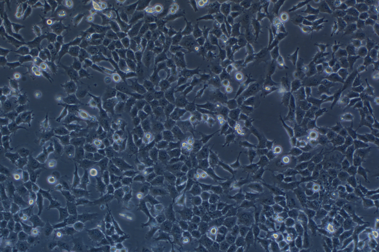 人胚胎滋養細胞HTR-8/Svneo (STR鑒定正確)