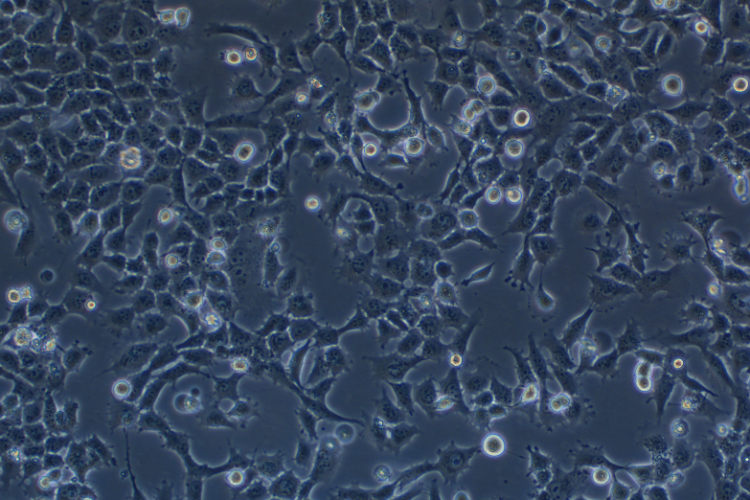 人胚胎滋養細胞HTR-8/Svneo (STR鑒定正確)