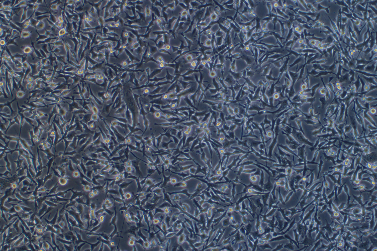 人甲狀腺癌細(xì)胞CAL-62(STR鑒定正確)