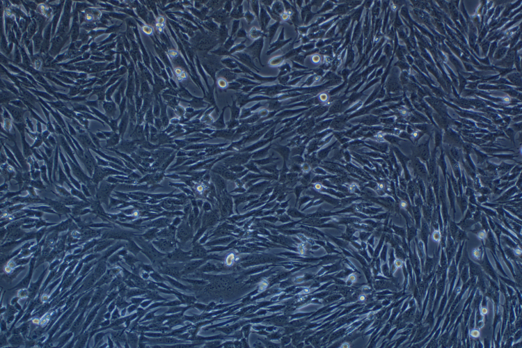 小鼠骨髓間充質干細胞永生化
