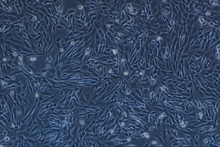 小鼠骨髓間充質干細胞永生化