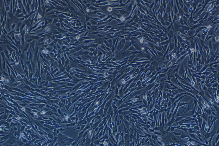 小鼠骨髓間充質干細胞永生化