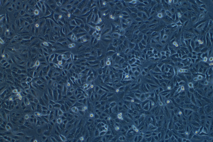 人肺癌細胞A549(STR鑒定正確)