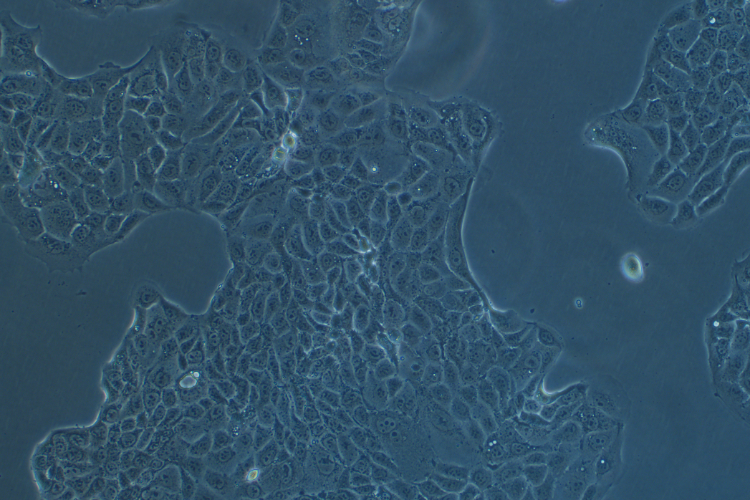 人肺腺癌細胞Calu-3(STR鑒定正確)