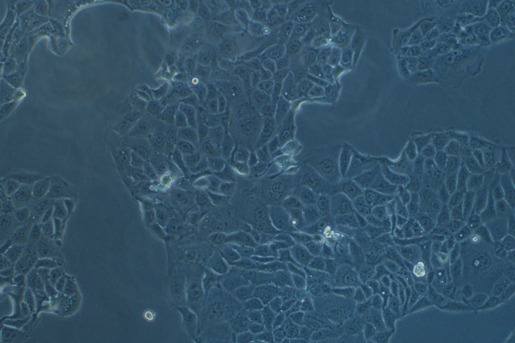 人肺腺癌細胞Calu-3(STR鑒定正確)