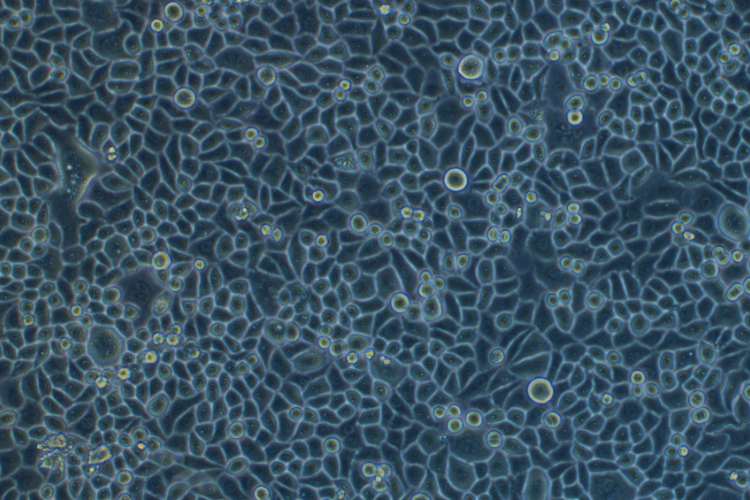 人宮頸癌細胞Hela (STR鑒定正確)
