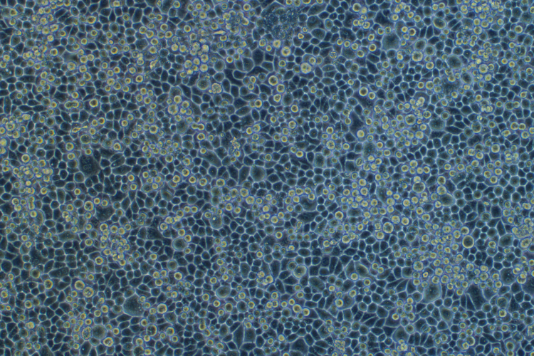 人宮頸癌細胞Hela (STR鑒定正確)