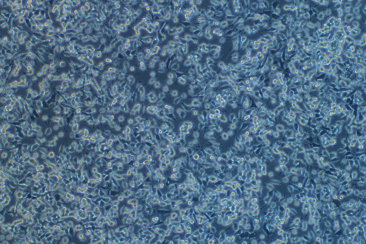 人鼻咽癌細胞C666-1(STR鑒定正確)