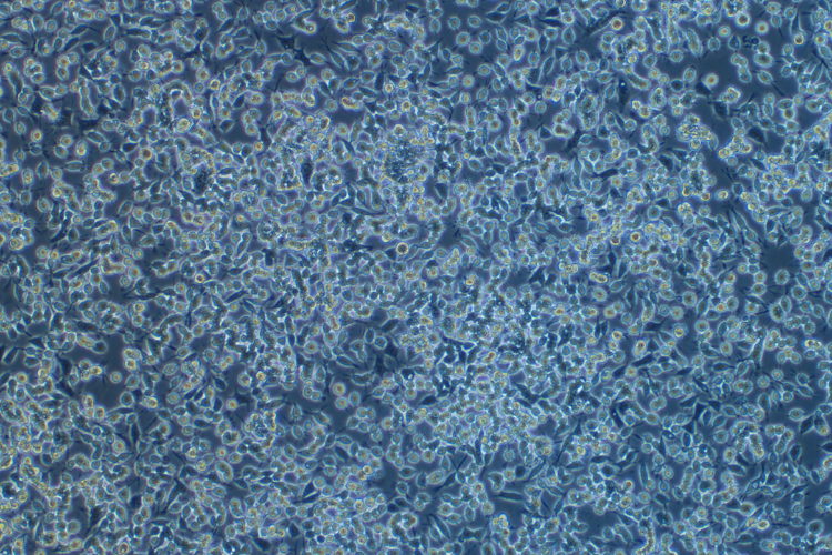 人鼻咽癌細胞C666-1(STR鑒定正確)
