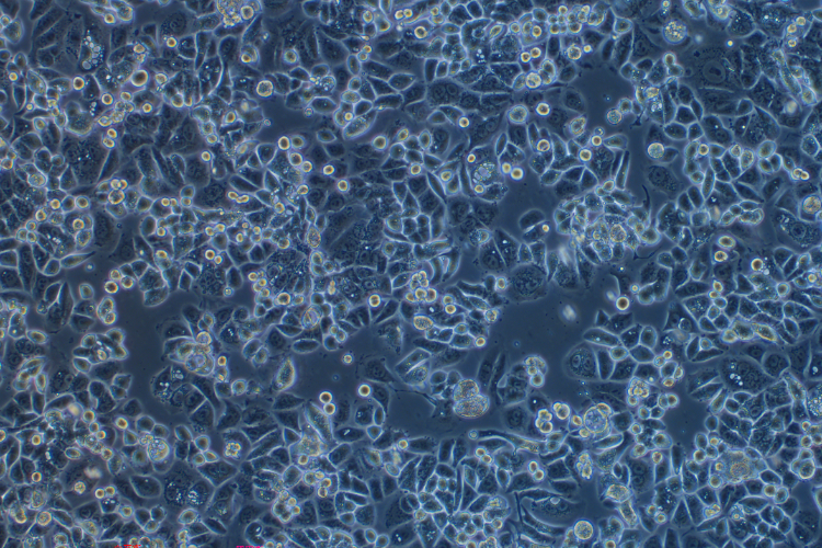 人乳腺腺癌細胞SK-BR-3(STR鑒定正確)