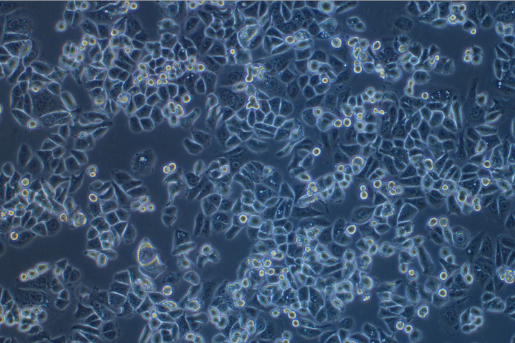 人乳腺腺癌細胞SK-BR-3(STR鑒定正確)