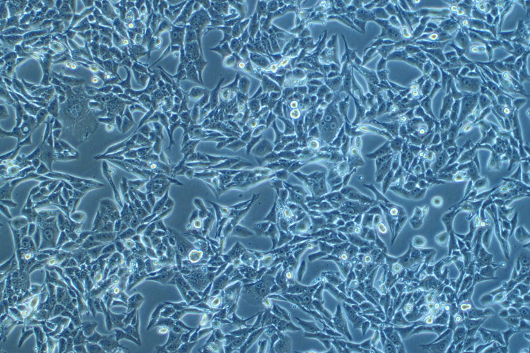 小鼠腎癌細胞Renca(種屬鑒定)